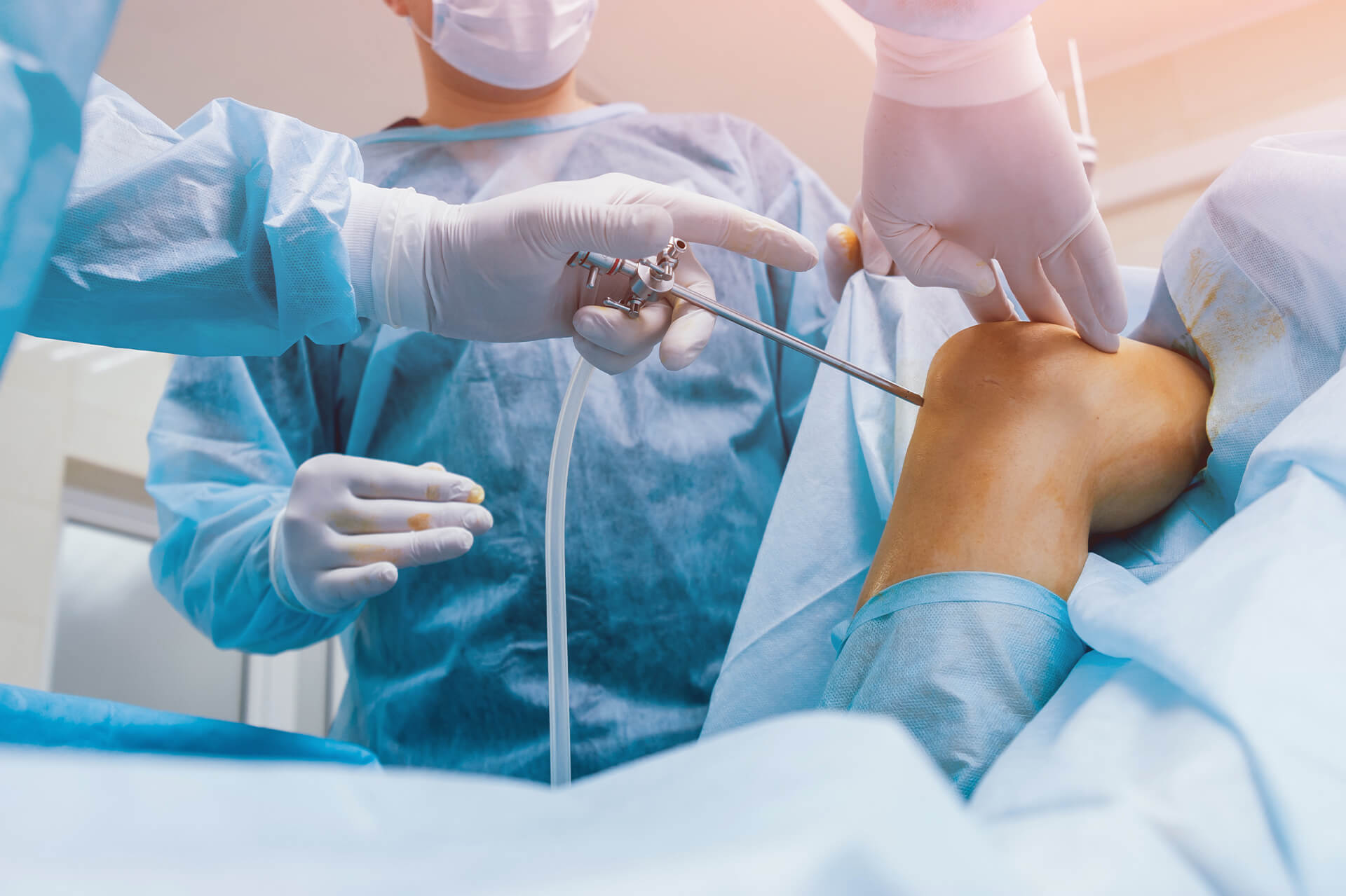Auf diesem Bild sieht man eine Operation, die das Kreuzband operiert. Auf dem Bild sieht man zwei Ärzte. Einer der Ärzte hat ein Gerät in der Hand, die ins Knie geht. Dieses Gerät wird wahrscheinlich zum absaugen benutzt. Das Knie ist mit einer Orangenschicht eingecremt.